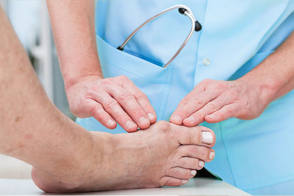 Role of Podiatry in Arthritis Management