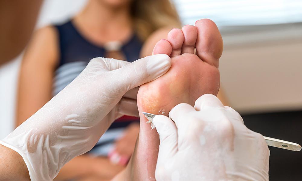 The Importance of Foot Care for Athletes
