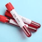 Regular STD Testing